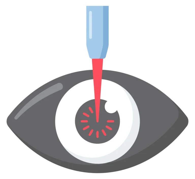 Medical eye laser treatment illustration